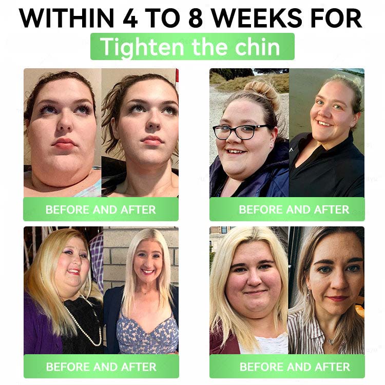 👩‍⚕️Alcuras™ Moringa × Berberine × AMPK 8-Benefit Slimming & Metabolic Nano Microneedle Patch 🇺🇸  Just once a day · Visible changes in 7 days  ✅ For obesity, loose skin, diabetes, sleep apnea, joint issues, and more🍀🍀🍀