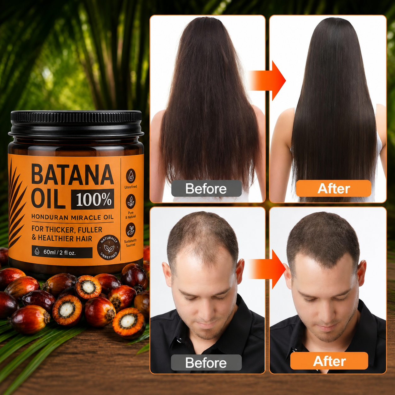 🔥BUY 1 GET 1 FREE🔥Batana Oil for Hair Growth,Raw Organic Batana Mask from Honduras🌱